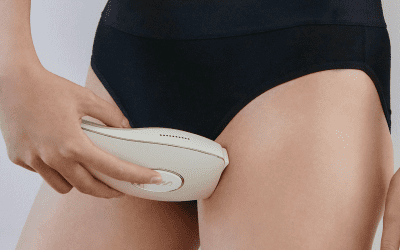 Bikini wax results vs IPL hair removal bikini results