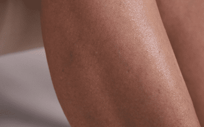 how-much-does-laser-hair-removal-cost